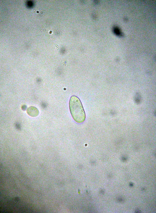Patologia vegetale, fungo, myxo...?